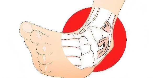 踝關(guān)節(jié)扭傷后的最佳應(yīng)對(duì)指南：簡(jiǎn)單四步，助力快速康復(fù)！