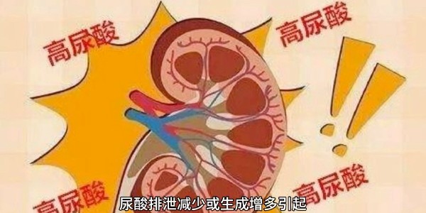 突然痛風(fēng)？別再只怪啤酒和燒烤！真正的“尿酸元兇”遠(yuǎn)比你想的多！