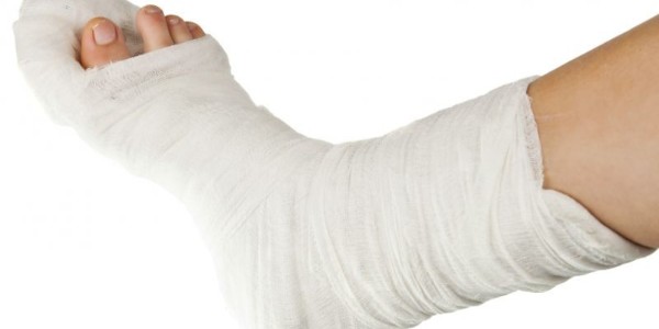 如何拆除紗布石膏